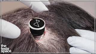 Neuralink Reveals Major New Update!