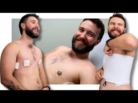 My Post Op Recovery & Results | Top Surgery Vlog Part 2