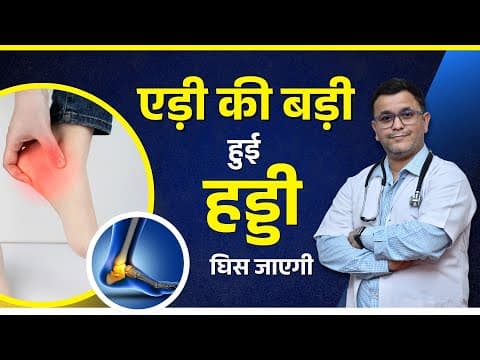 एड़ी की हड्डी बढ़ जाए तो क्या करें? 3 Best Homeopathic Medicine For Heel Spur