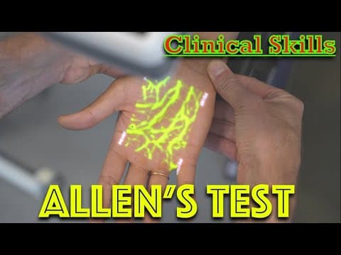 Allen's Test For blood flow - Hand Examination - Dr Gill