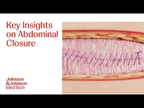 Don't Fear The (small) Bite! Abdominal Closure Techniques, Evidence & Misconceptions | J&j Medtech