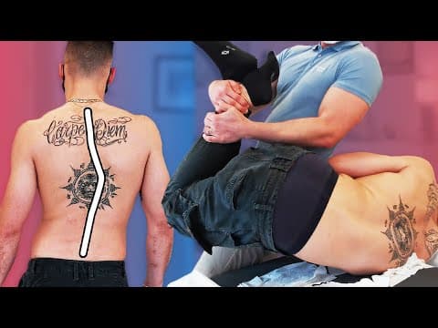 Chiropractor Fixes This Severe Spine Deformation (before & After)