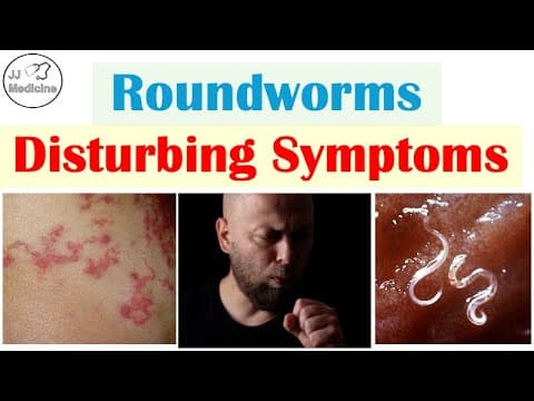 5 Horrifying Symptoms Of Roundworm Infections