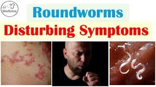 5 Horrifying Symptoms Of Roundworm Infections