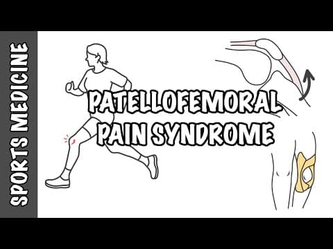 Patellofemoral Pain Syndrome - Runner's Knee