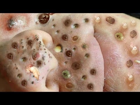 𝐄𝐧𝐣𝐨𝐲 𝐭𝐡𝐞 𝐬𝐮𝐫𝐩𝐫𝐢𝐬𝐞 𝐟𝐫𝐨𝐦 𝐋𝐨𝐚𝐧𝐍𝐠𝐮𝐲𝐞𝐧 #56183875