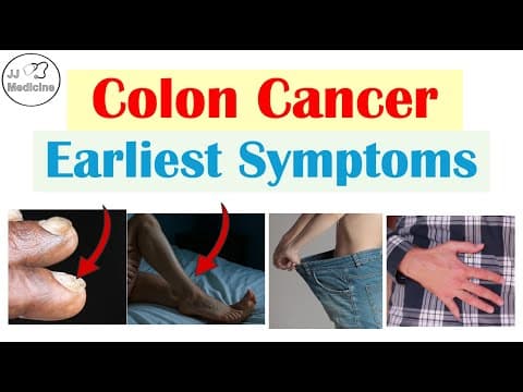 5 Early Symptoms Of Colon Cancer (colorectal Carcinoma)