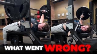 Arm Broke While Bench Press |dangerous Accident In Gym|