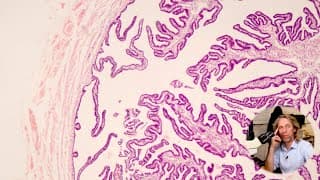 Histology Of The Fallopian Tube