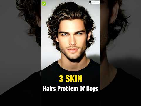 4 Skin & Hair Problems Every Man Faces ✅ || #shorts #viral