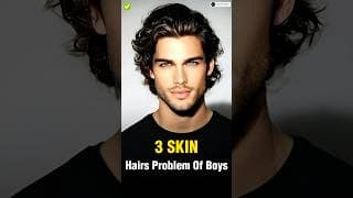 4 Skin & Hair Problems Every Man Faces ✅ || #shorts #viral