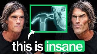 Inside The Dangerous World Of Looksmaxxing