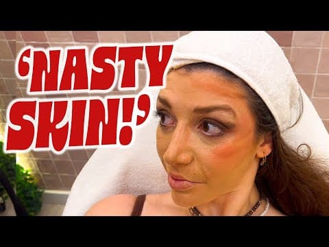 My Skin Ruined Her Makeup