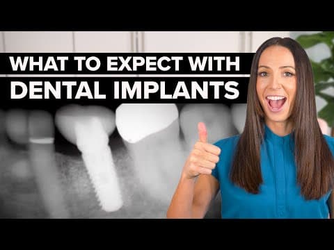 What To Expect With Dental Implants