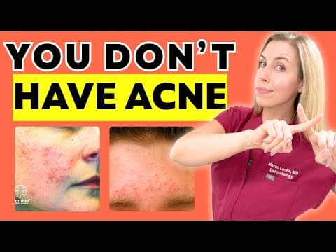 You Don't Have Acne!!! You Have This! | And How To Fix It
