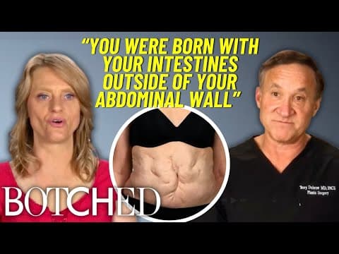Sandra Was Born With Her Intestines Outside Of Her Body?! *full Transformation* | Botched | E!