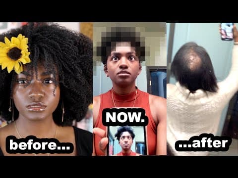 I Styled My Bald Patch For A Week... | 4c Natural Hair