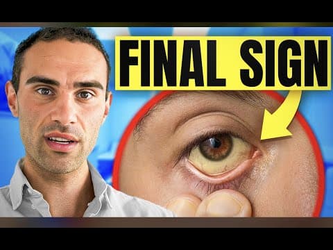 10 Warning Signs Of Liver Disease (don't Ignore These)