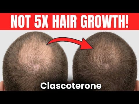 539% Hair Growth?! Clascoterone 5% 2026 Update