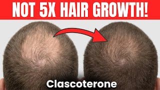 539% Hair Growth?! Clascoterone 5% 2026 Update