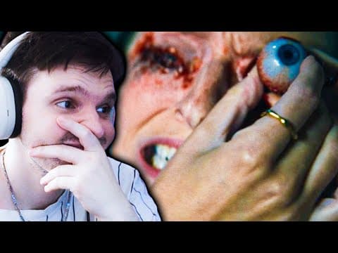 Ich Konnte Das Nicht Zu Ende Schauen.. (video Abgebrochen)