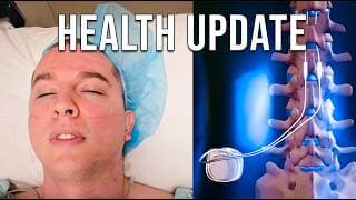 Recovering From Spinal Cord Stimulator Implant Surgery (health Update)
