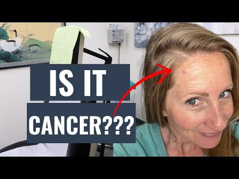 Is It Cancer? | My Recent Skin Cancer Journey.