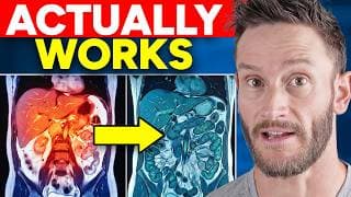 This Fasting Method Makes Inflammation Vanish (works On Day 1)