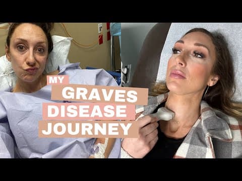 Part 2: Grave’s Disease/thyroid Journey - Q&a With My Doctor, Josh Redd |  Jordan Page