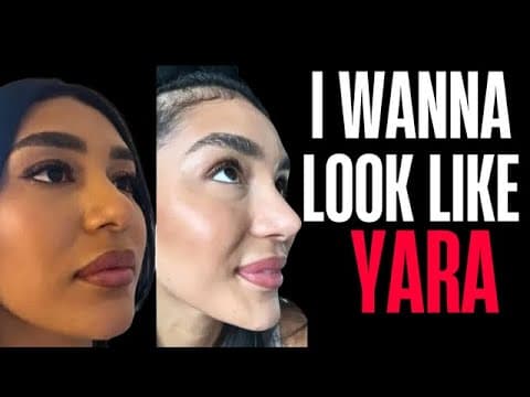 Plastic Surgery Is Ruining This Womans Life | 90 Day Fiancé