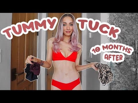 Tummy Tuck 10 Months Post Surgery