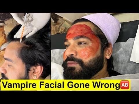 Vampire Facial And Hair Prp || Aisa Facial Pehli Bar Dekha