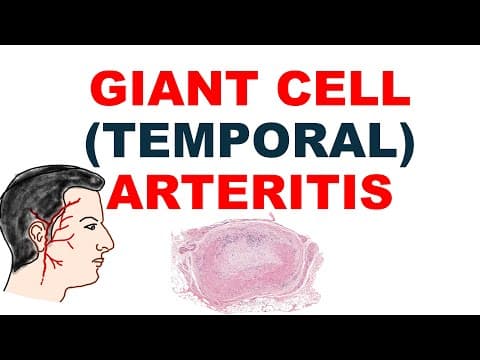 Giant Cell (temporal )arteritis  | Pathogenesis, Pathology & Clinical Features | Vasculitis – Part 2