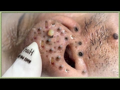 𝐄𝐧𝐣𝐨𝐲 𝐭𝐡𝐞 𝐬𝐮𝐫𝐩𝐫𝐢𝐬𝐞 𝐟𝐫𝐨𝐦 𝐋𝐨𝐚𝐧𝐍𝐠𝐮𝐲𝐞𝐧 #56183843