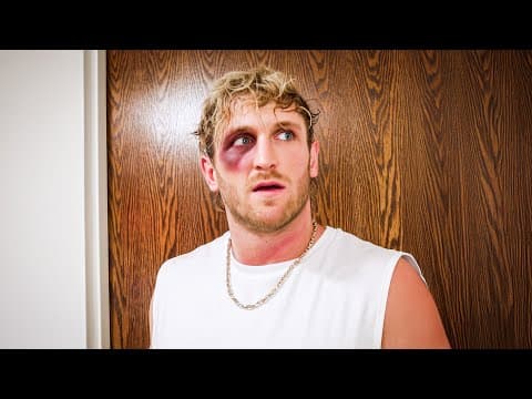 I Got Punched In The Face **not Clickbait**