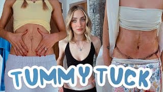 Tummy Tuck Recovery: Week 1 & 2 *very Raw And Real*