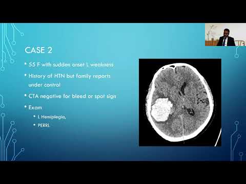 Session 5: Panel Discussion, Navigating Complex Mis Cases—insights And Strategies