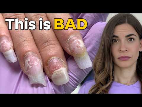 I Didn’t Expect The Damage To Be This Bad