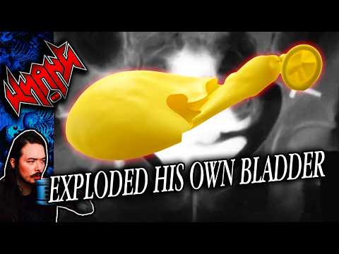 Exploded His Own Bladder - 1001 Ways To Die