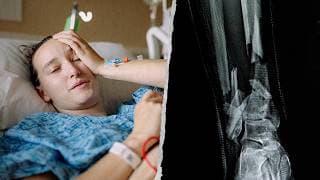 I Nearly Lost My Leg In A Rock Climbing Accident