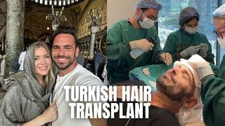 Hair Transplant In Turkey!! 😳 Istanbul + Cappadocia