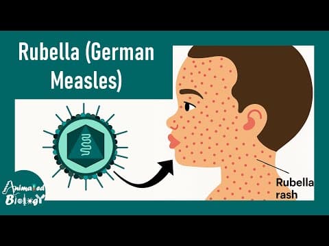 Rubella (german Measles) Explained | Causes, Symptoms & Prevention