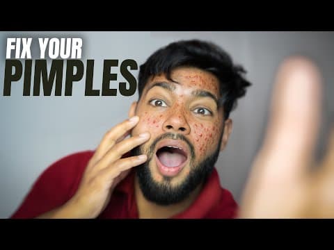 How To Reduce Acne Pimples At Home (naturally)