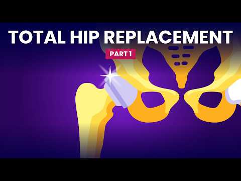 A Few Things Before You Replace Your Hip
