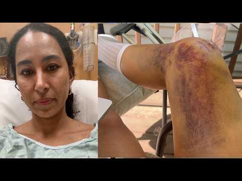 100 Days After My Crash: What No One Tells You