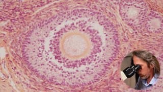 Histology Of The Ovary