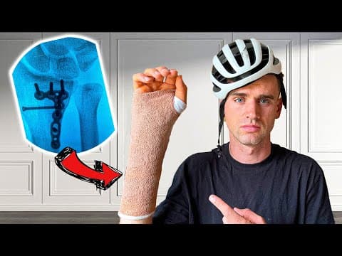I Fell Off My Bike And Broke My Wrist