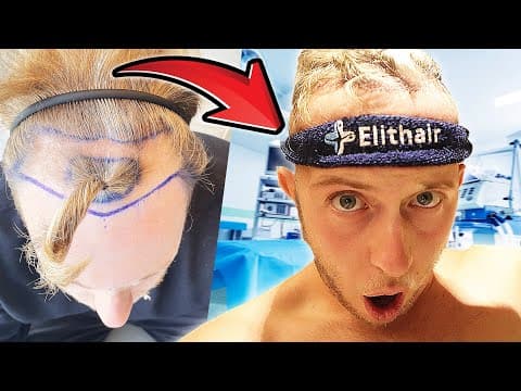 Flying To Istanbul For A Hair Transplant