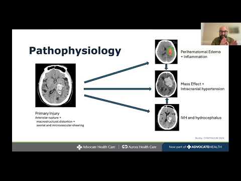 Session 1: Understanding Pathophysiology And Optimizing Medical Management