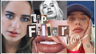Ur Lip Filler May Be Botched But Mine Isn't (anymore) Lol | Los Angeles Daily Vlog